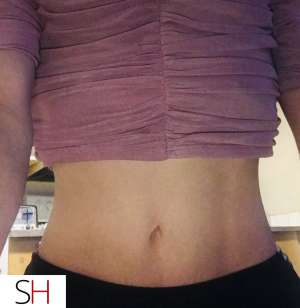 32 year old Caucasian Escort in Ottawa Lovely Ellaa . OutCallss! Slim Doll Ready To Play