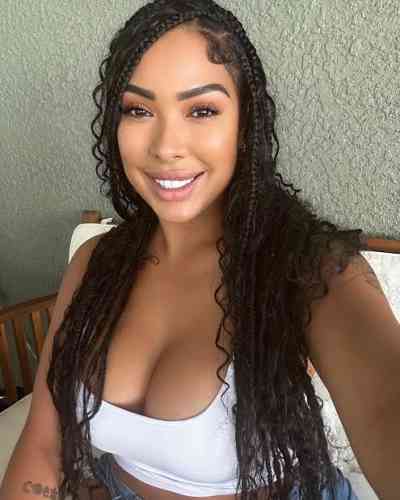 28Yrs Old Escort Agency escort girl in: Tirana Image - 1