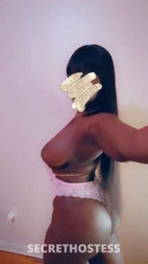 Amazon 24Yrs Old Escort Image - 1