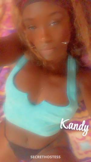 Kandy 30Yrs Old Escort Image - 6