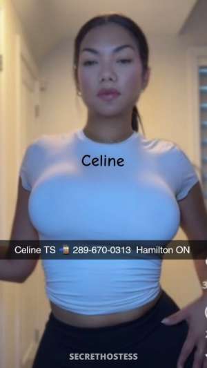 Celine 31Yrs Old Escort Kitchener Image - 9