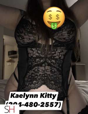 24Yrs Old Escort 165CM Tall Winnipeg Image - 2