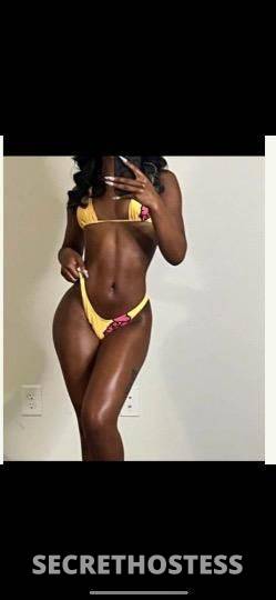 Candy 23Yrs Old Escort Toronto Image - 0
