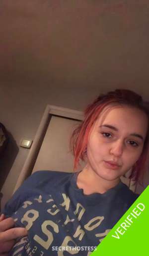 26 year old Escort in Welland SAFE💕 💯LEGIT✨💞SKILLED🍆😛💙EXOTIC Calling 