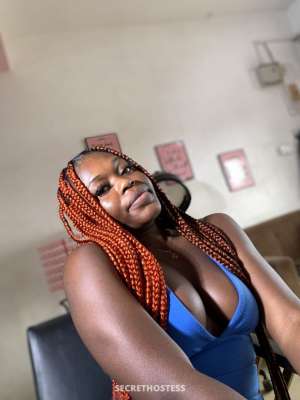25 year old Escort in Lomé Cheeszy, escort