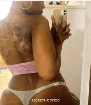 Sza 25Yrs Old Escort Oakville Image - 3