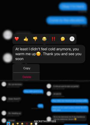 Malibu 23Yrs Old Escort Barrie Image - 3