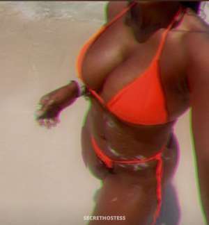 28Yrs Old Escort Westchester NY Image - 1