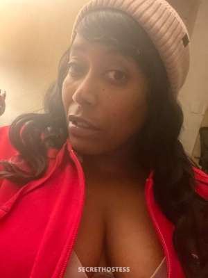 36 year old Escort in Springfield MA Sexy Amputee incall &amp; outcall Specials !!! 160 hhr 