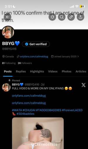  24 year old Escort in Milton