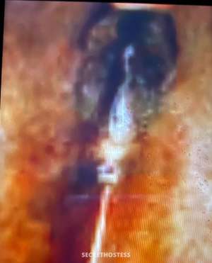 Mt Vernon 31 year old Escort in Carbondale IL