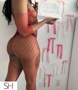 ꨄ︎ im back 5 22 year old Escort in Mississauga