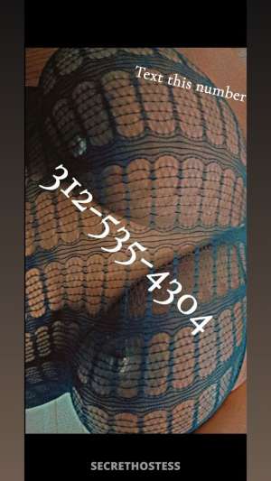 🔥 Horny Queen available For Hookup ✅ Incall ,Car Fun 22 year old Escort in Cedar Rapids IA