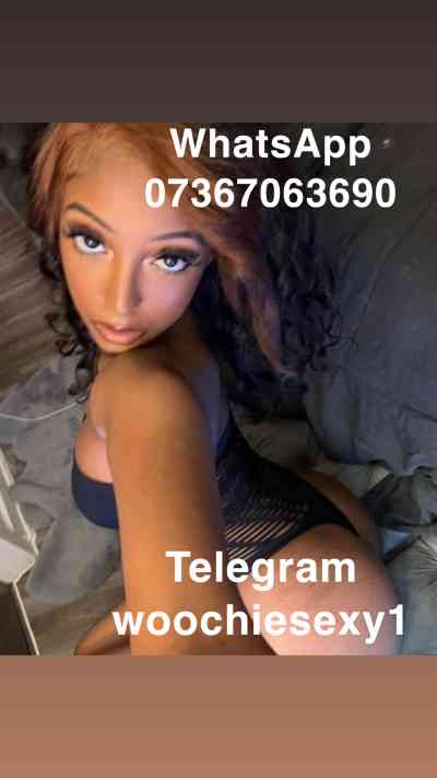 25 year old Black Escort in South East I’m available WhatsAxxxx-xxx-xxx