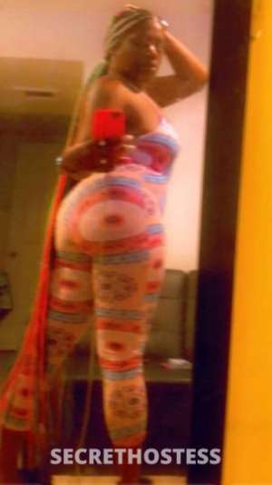 💦💧👄🍆head doctor 25 year old Escort in Syracuse NY