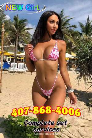 🟨🌈⭐🌈🟨💦 new girls new feeling🔴xxxx-xxx- 23 year old Escort in North Jersey