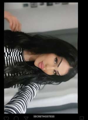 27 year old Escort in Durres Denisa