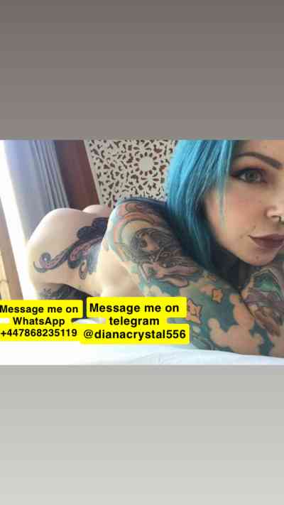 27Yrs Old Escort Spalding Image - 1